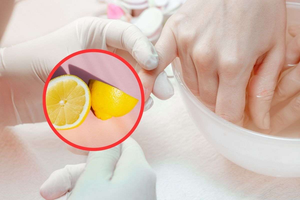 limone sulle unghie: tutti i benefici